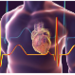 Feinberg Investigators Lead AHA Heart Disease Research Initiative 